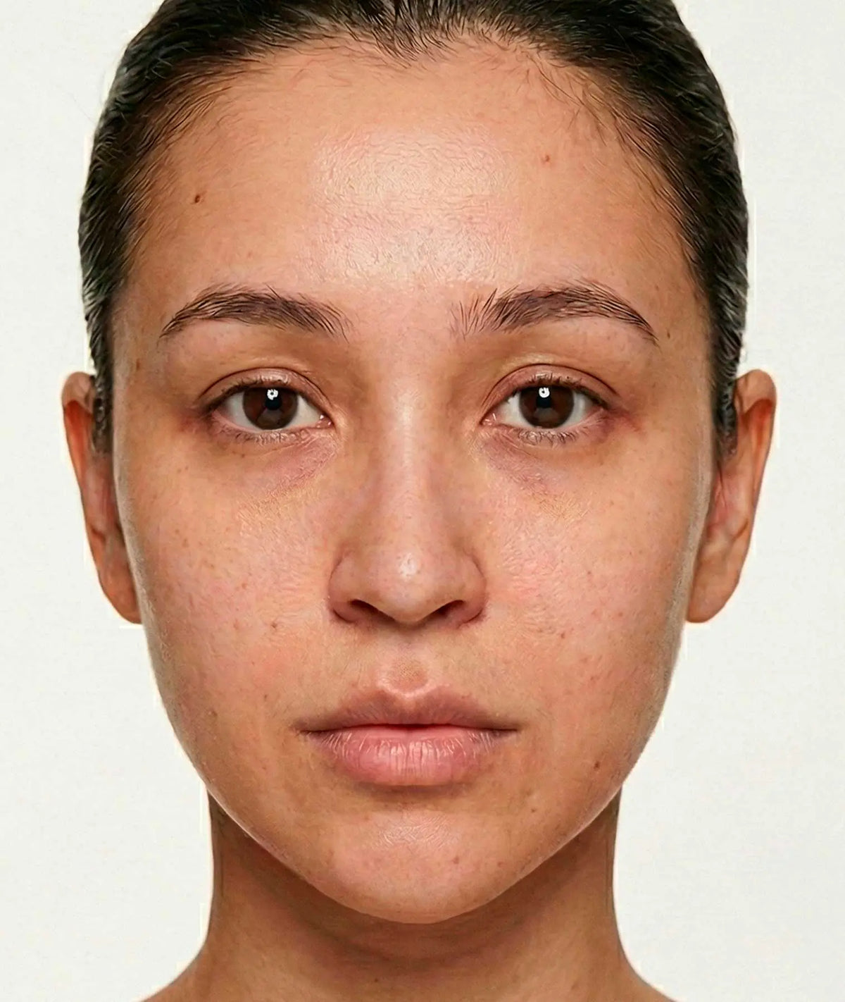 Mujer joven antes de probar el DÚO ESENCIAL DE LOYA