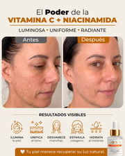SERUM FACIAL MULTITASKING - HIDRATANTE, NUTRITIVO Y ANTIEDAD 30 ML